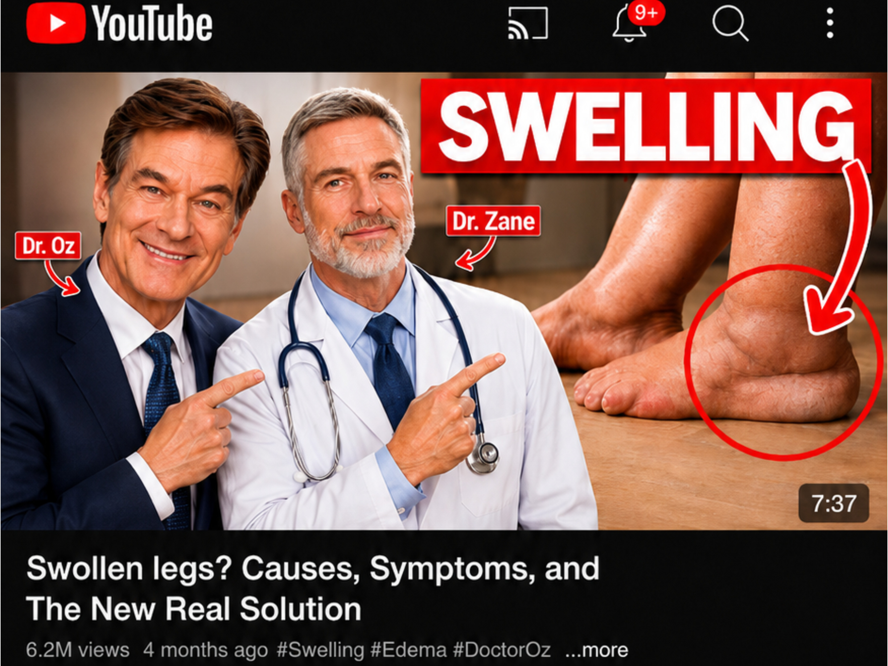 Dr. Zane discusses swelling in a video that has passed 6.2 million views